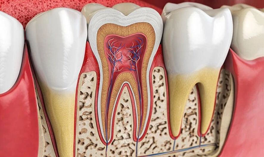 Лікування каналів - стоматолог Чернівці